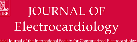 Journal of Electrocardiology